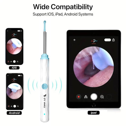 Smart Visual Ear Wax Cleaner r3fvcs-m6