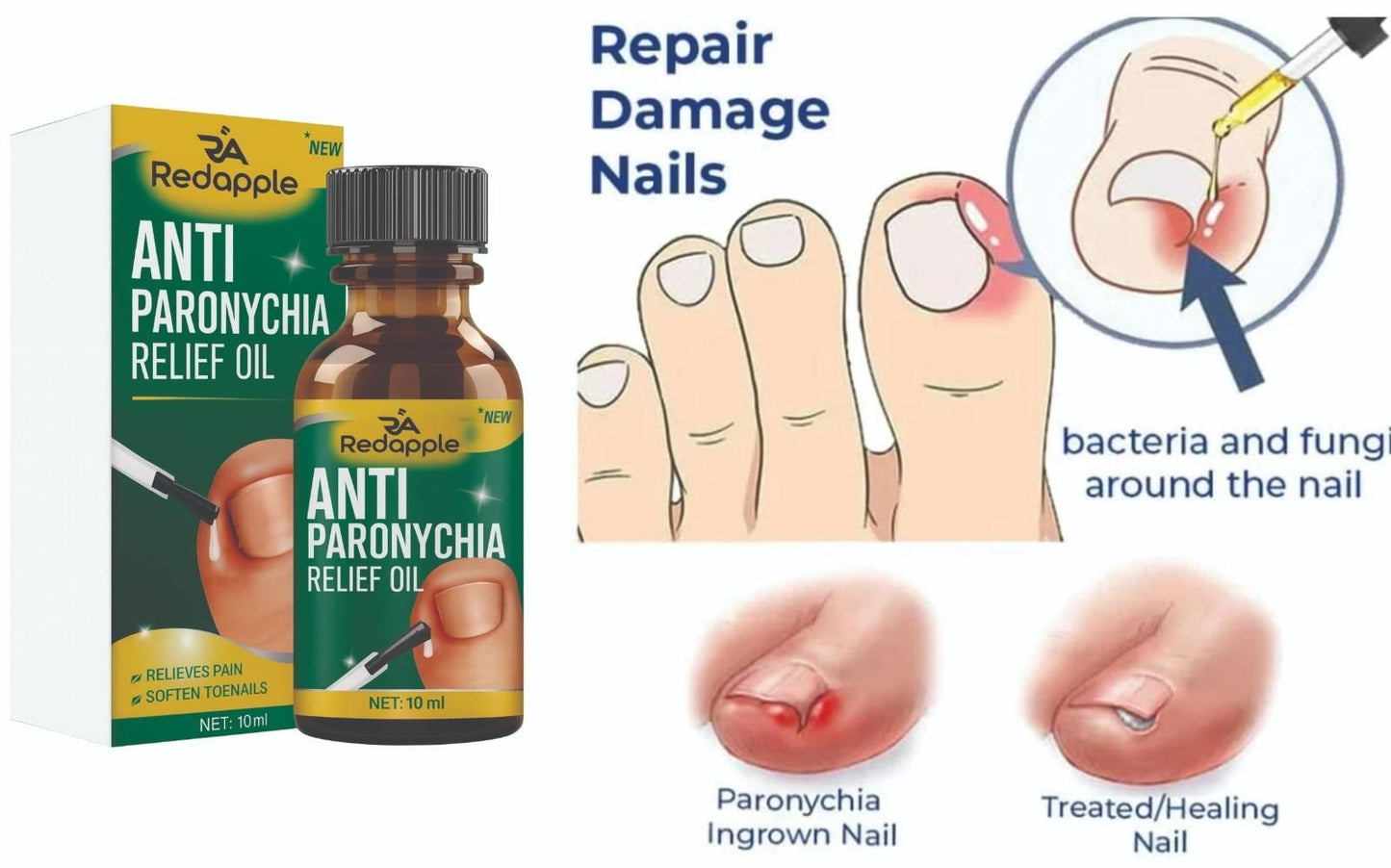 Anti Paronychia Relief Oil 20 ml Pack of 2 r3fvcs-m6