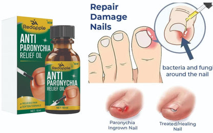 Anti Paronychia Relief Oil 20 ml Pack of 2 r3fvcs-m6